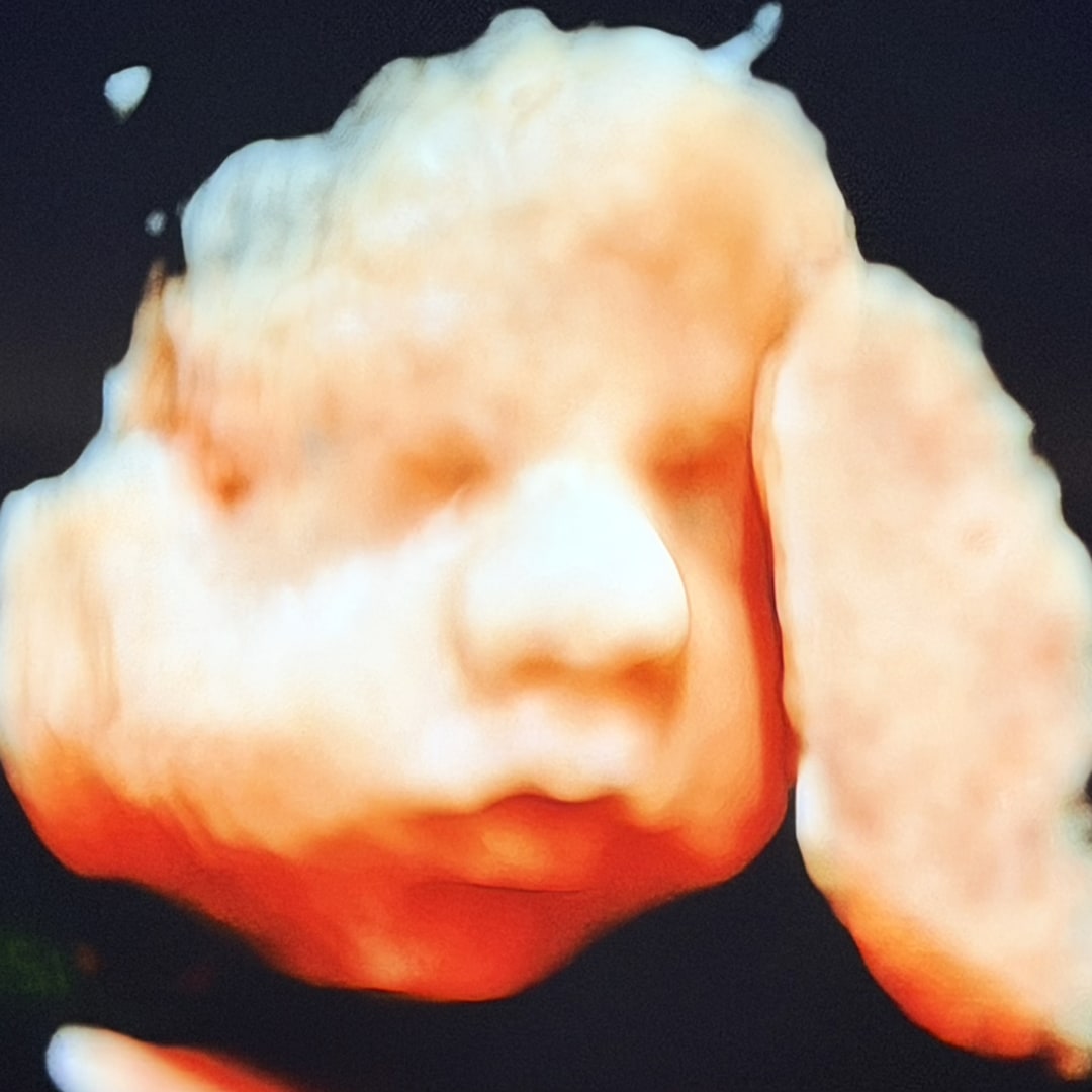 Photo shared by Dana for their Babylist baby registry.