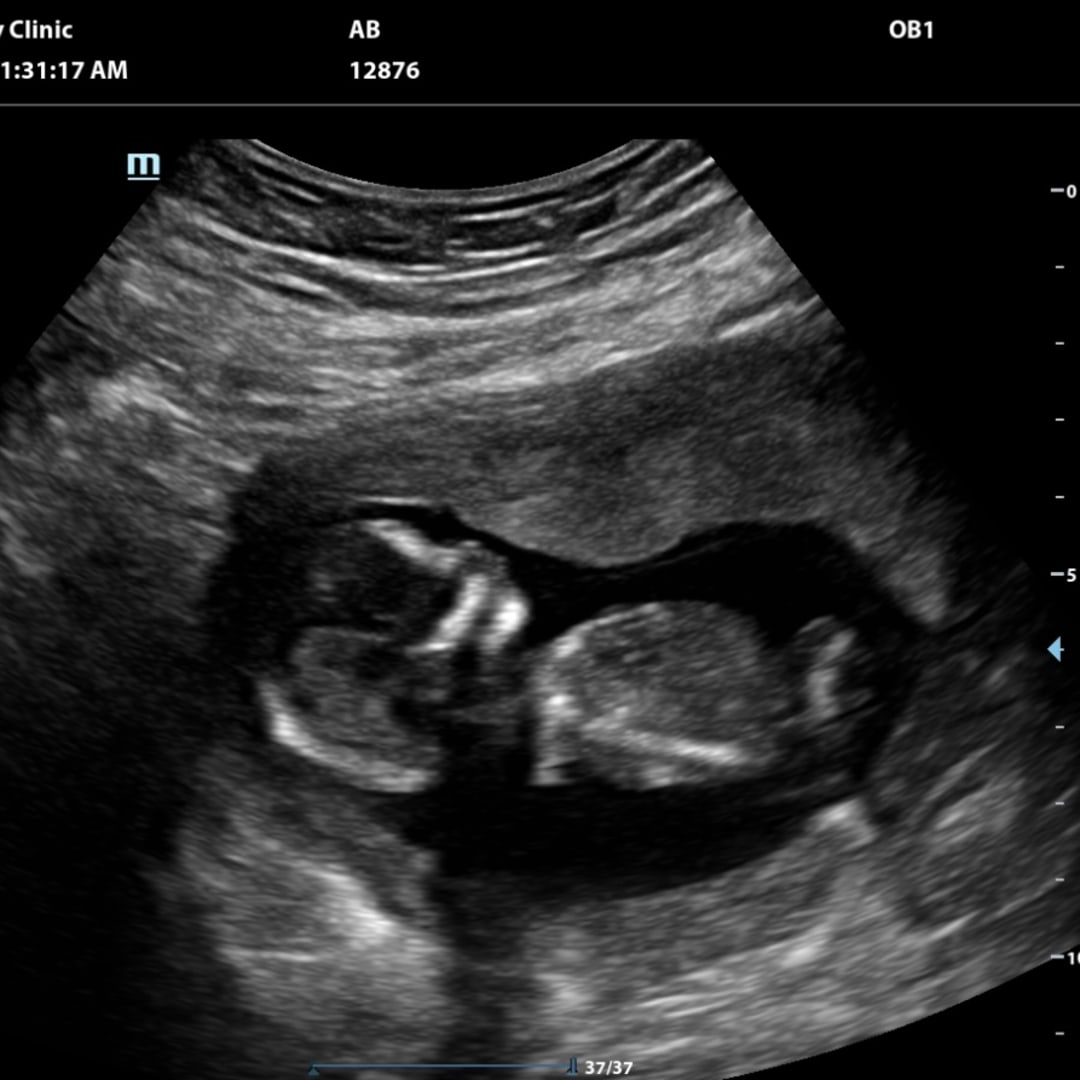 Photo shared by Angelicas for their Babylist baby registry.