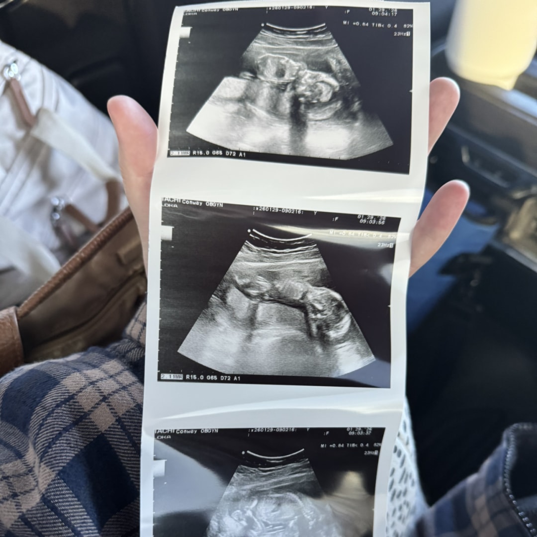 Photo shared by Kaylynn for their Babylist baby registry.