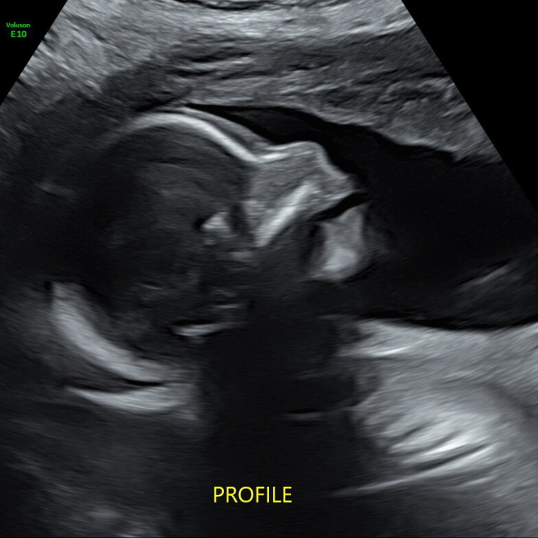 Photo shared by Mackenzie for their Babylist baby registry.