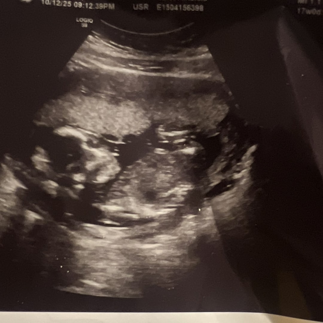 Photo shared by Alneicia & Jackobi for their Babylist baby registry.