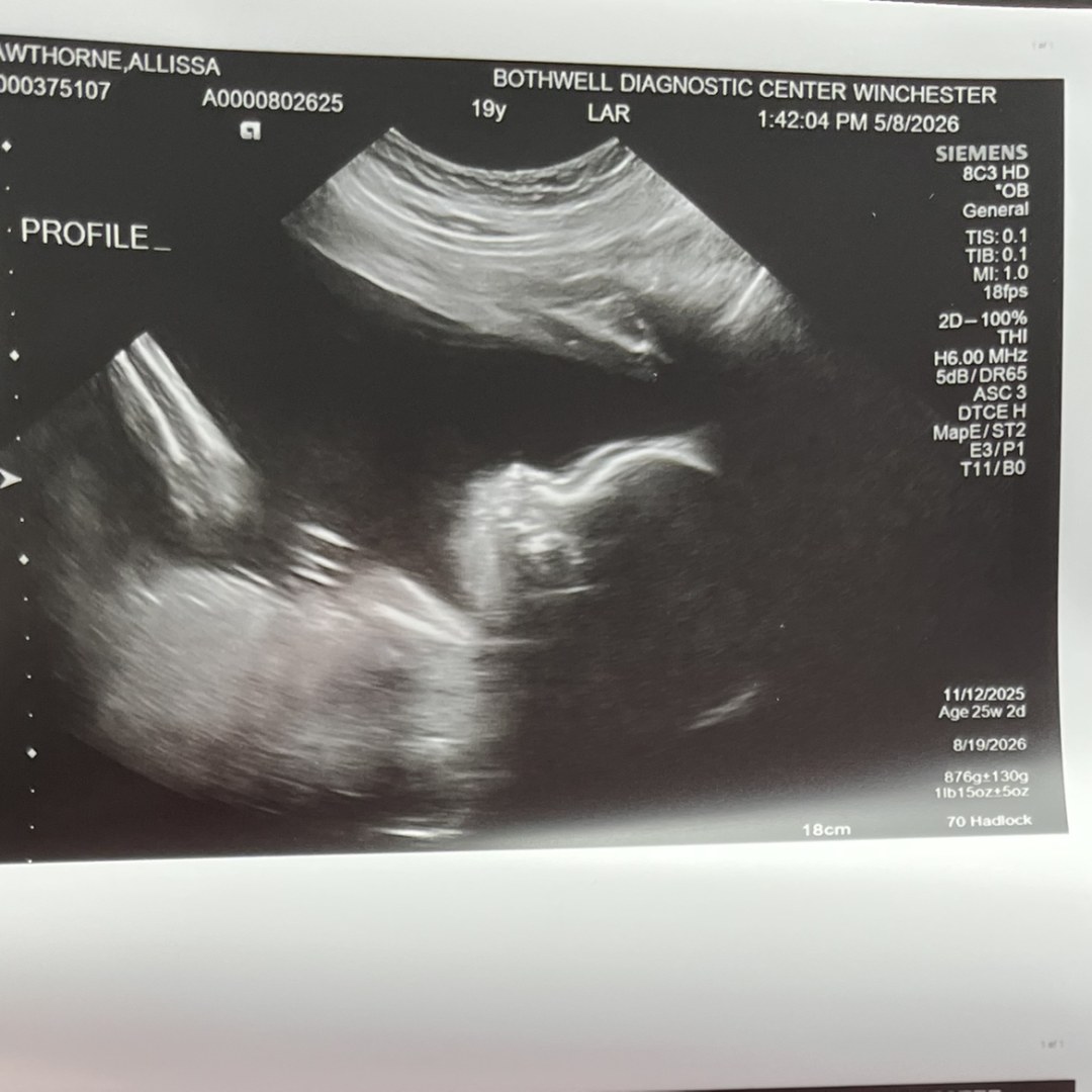 Photo shared by Allissa for their Babylist baby registry.