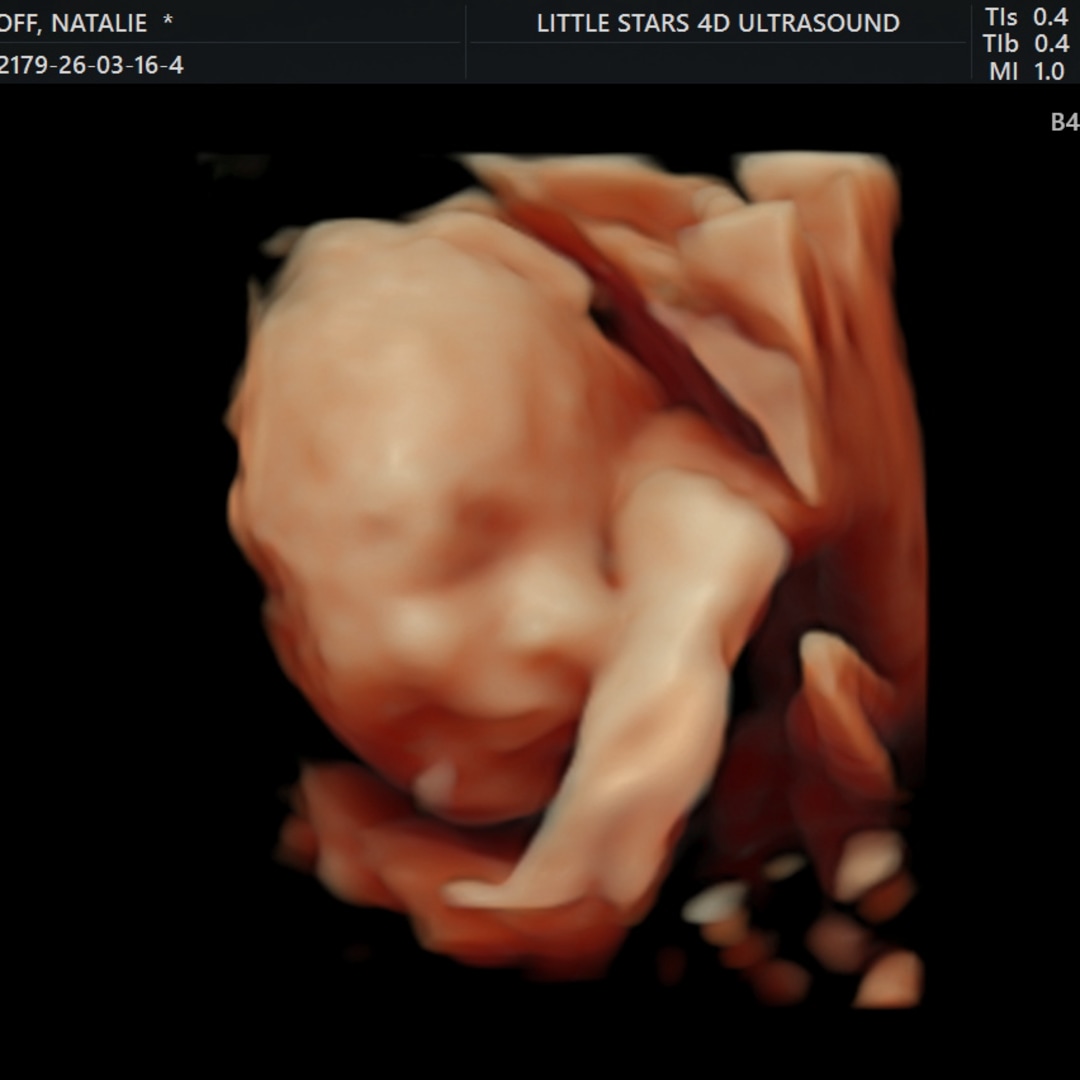 Photo shared by Natalie for their Babylist baby registry.