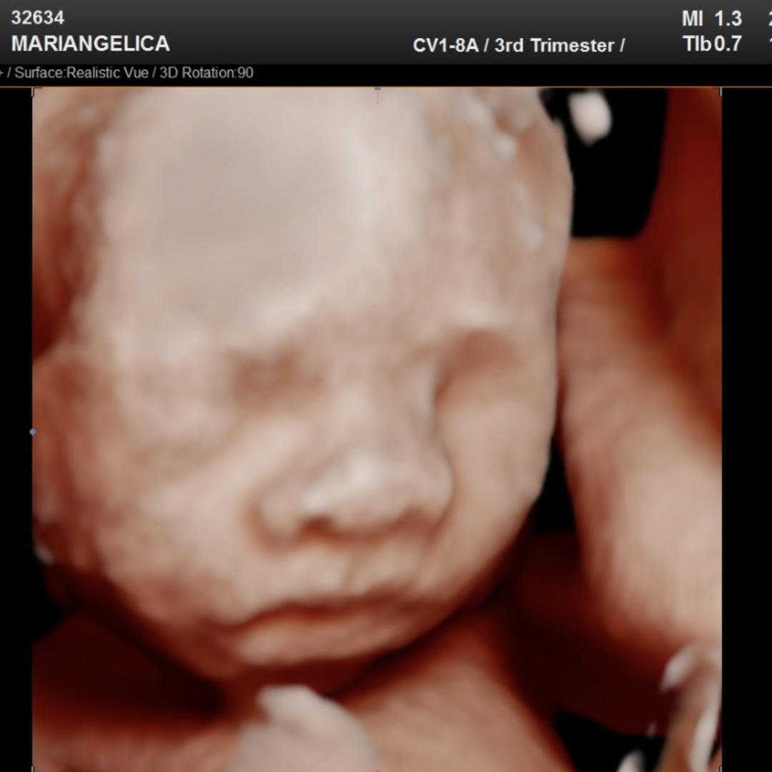 Photo shared by Mariangelica for their Babylist baby registry.