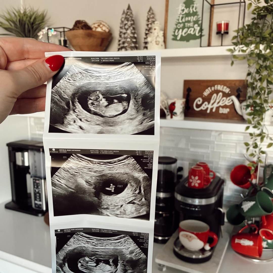 Photo shared by Katie for their Babylist baby registry.