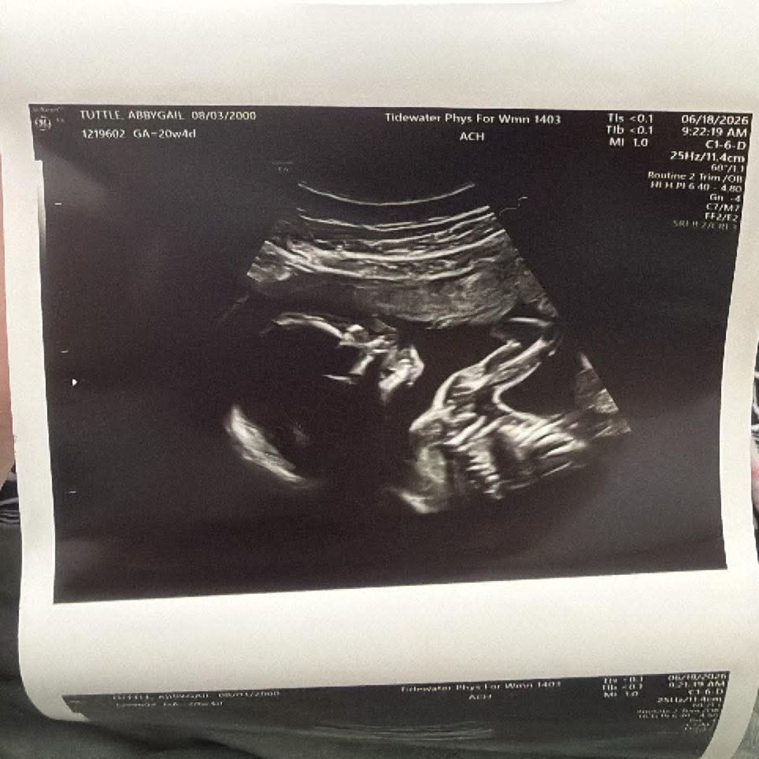 Photo shared by Abby for their Babylist baby registry.