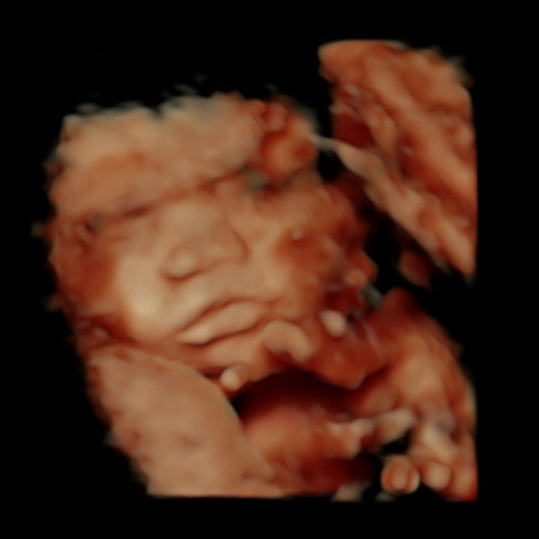 Photo shared by Ashley for their Babylist baby registry.