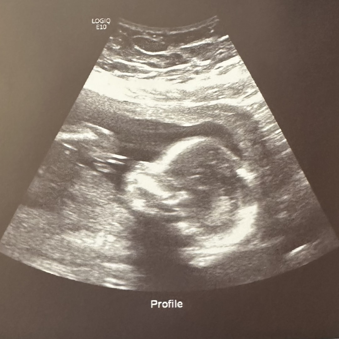 Photo shared by Kelsie for their Babylist baby registry.
