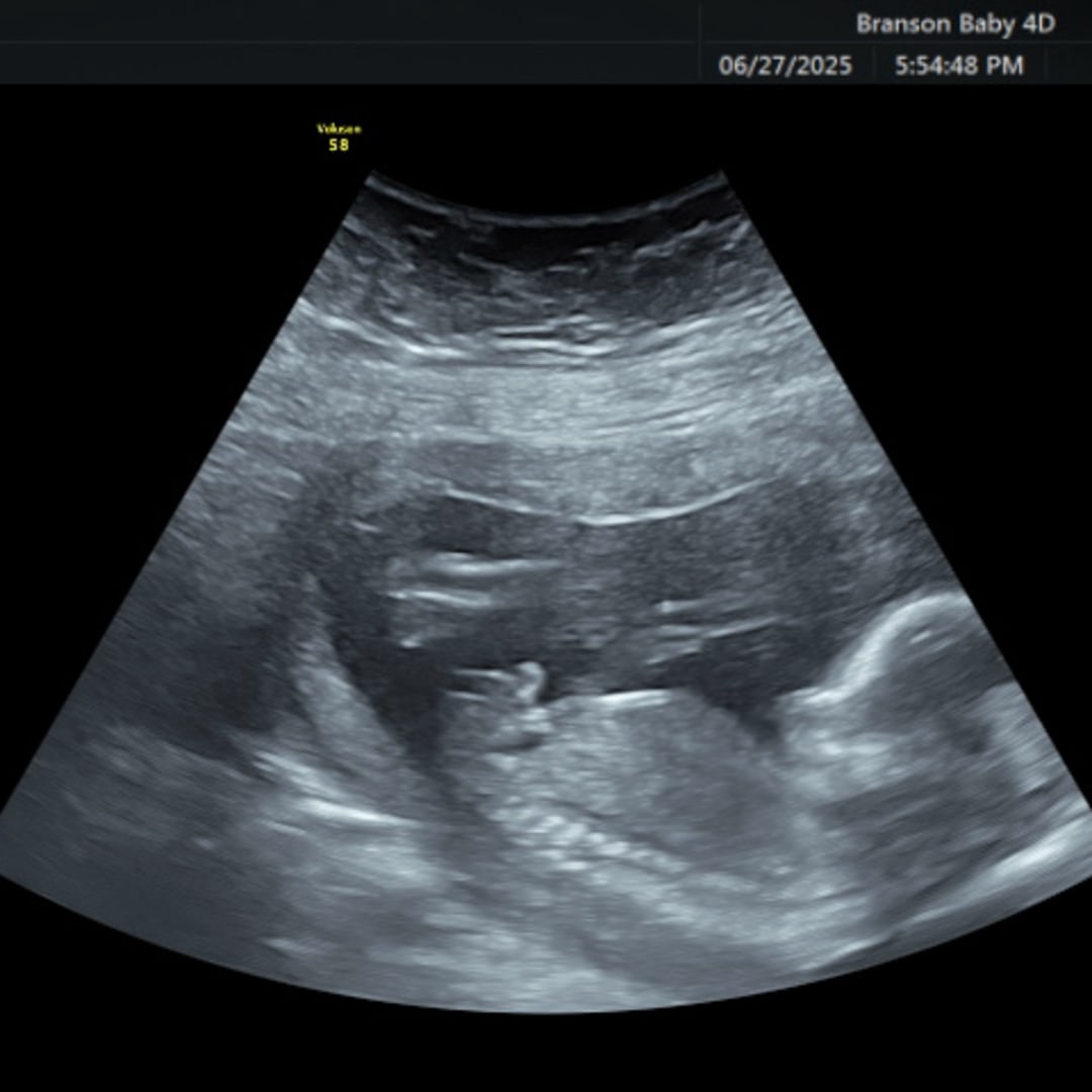 Photo shared by Bridget for their Babylist baby registry.