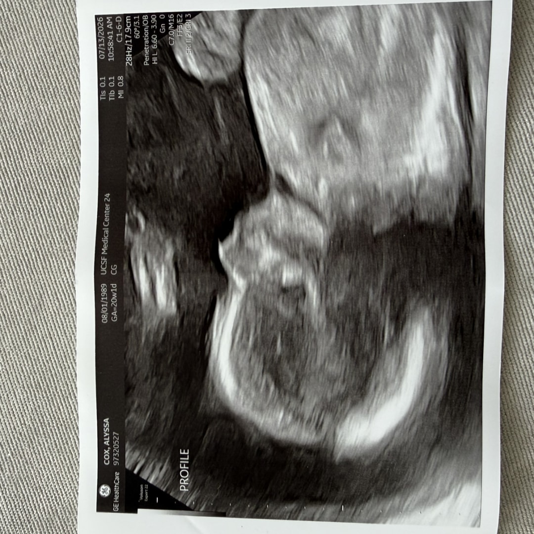 Photo shared by Alyssa for their Babylist baby registry.