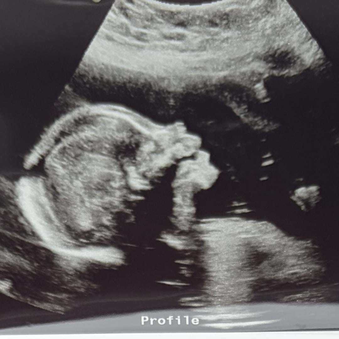 Photo shared by Elyse for their Babylist baby registry.