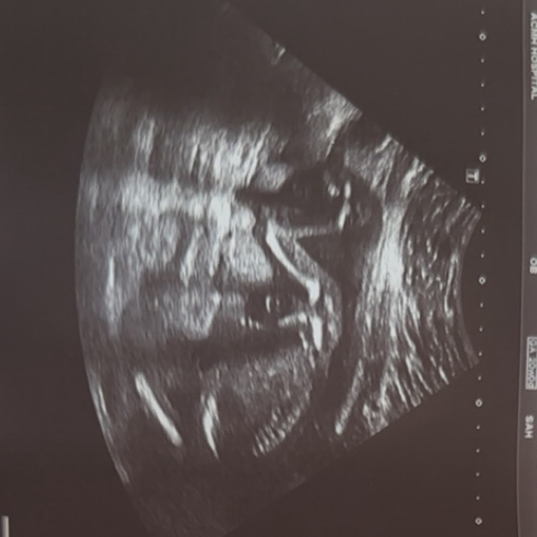 Photo shared by Camryn for their Babylist baby registry.