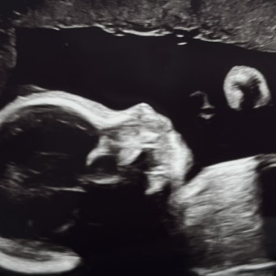 Photo shared by Alyssa for their Babylist baby registry.