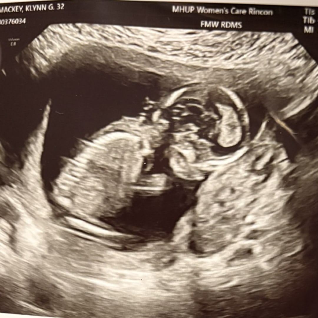 Photo shared by K’Lynn for their Babylist baby registry.