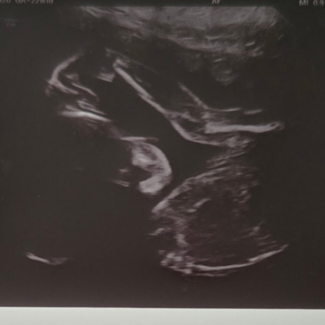 Photo shared by Jeannette for their Babylist baby registry.