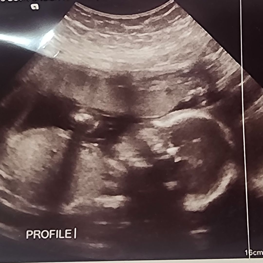 Photo shared by Sarah for their Babylist baby registry.