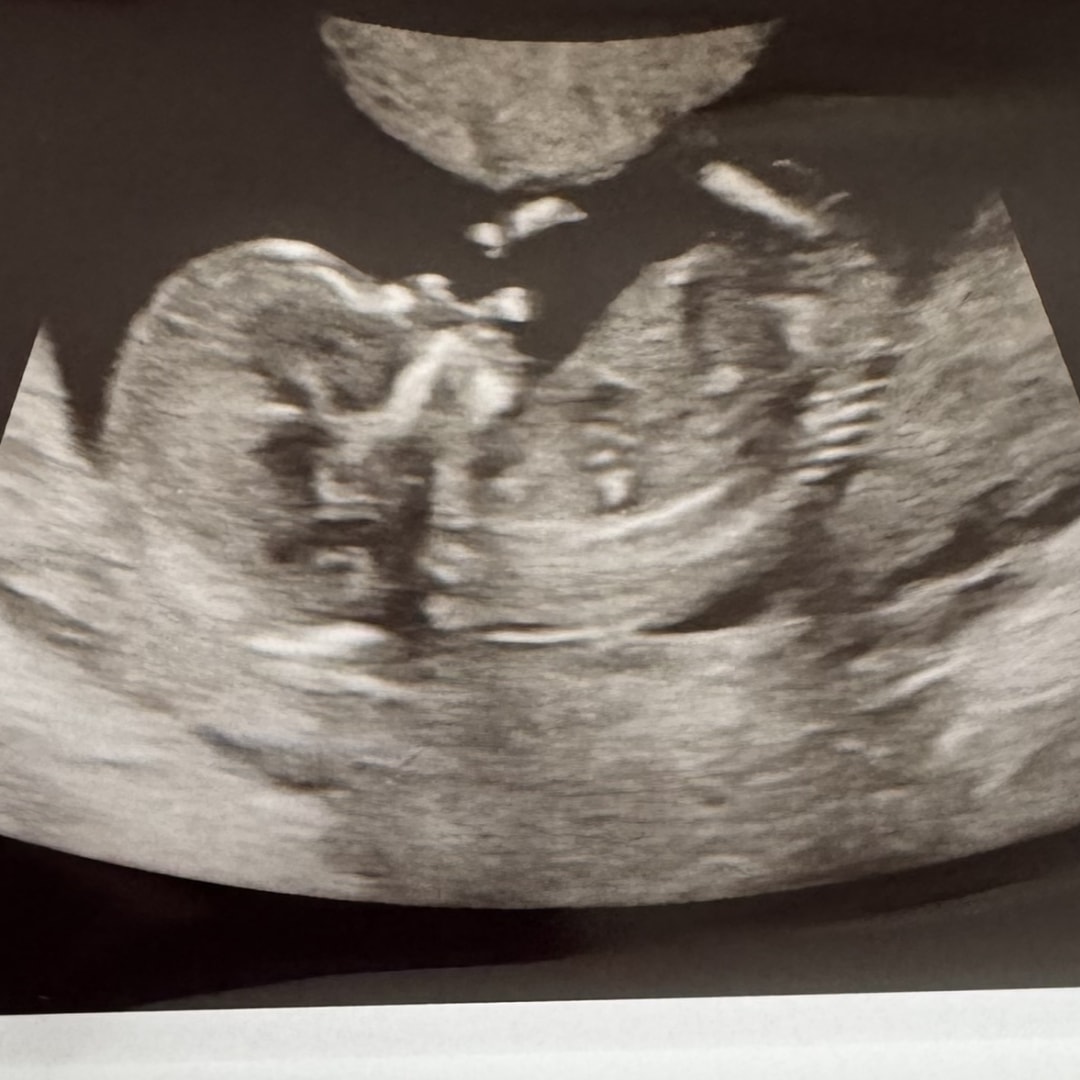 Photo shared by Amber for their Babylist baby registry.