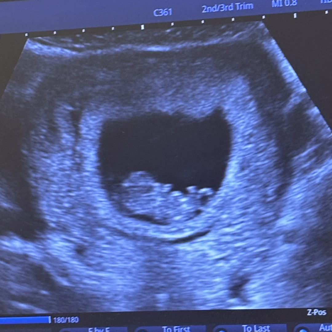 Photo shared by Ava for their Babylist baby registry.