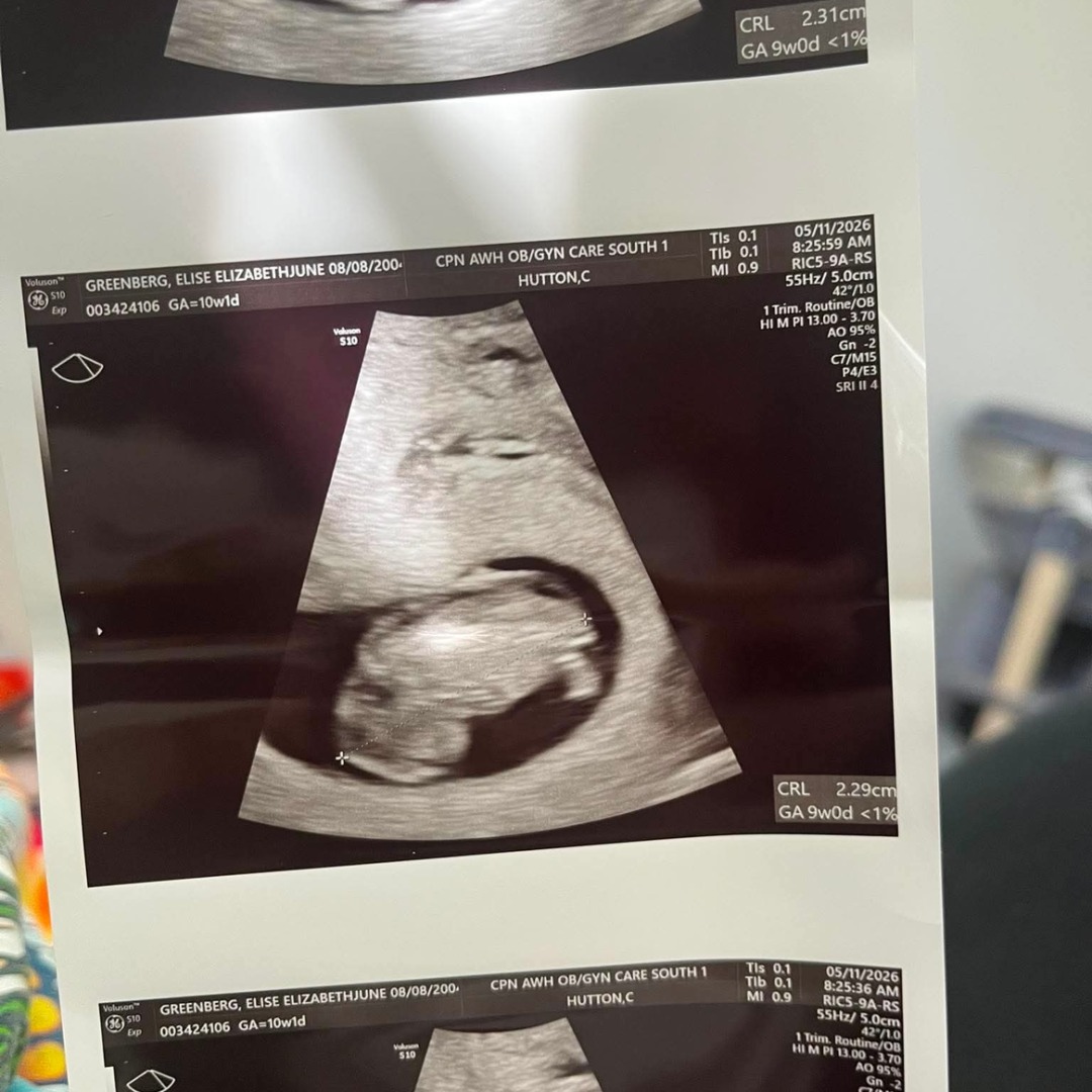 Photo shared by Elise for their Babylist baby registry.