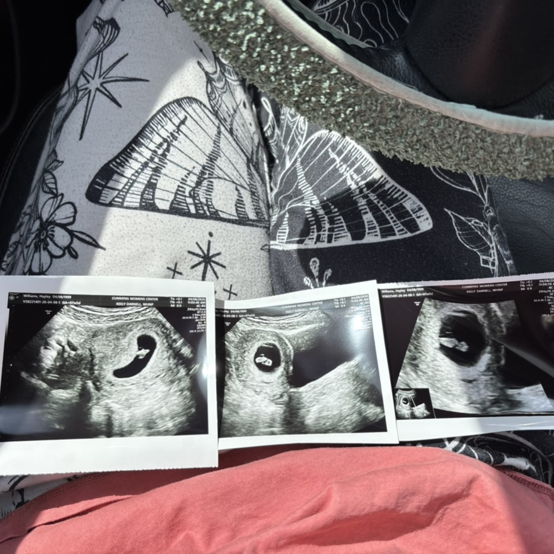 Photo shared by Hayley for their Babylist baby registry.