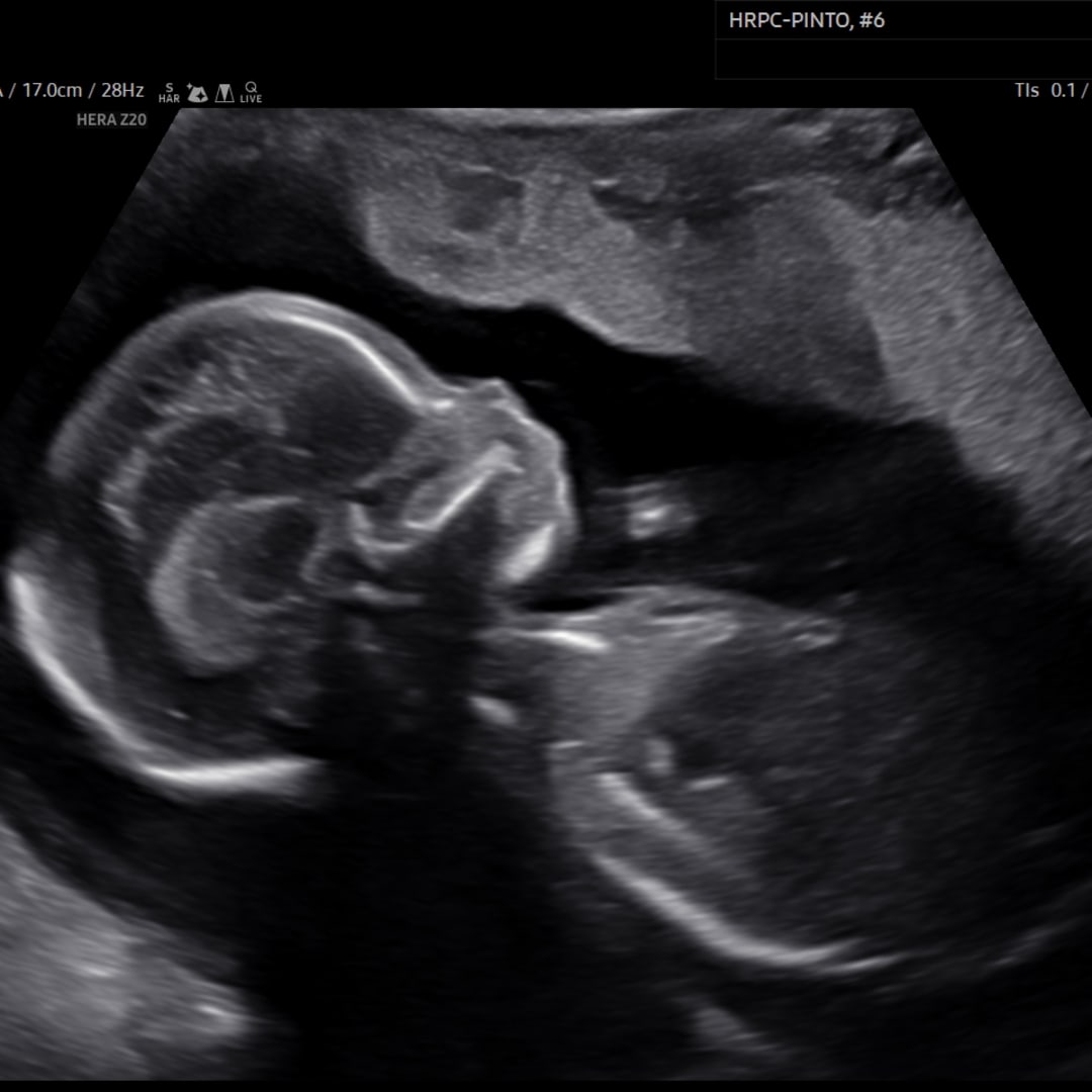 Photo shared by Esraa for their Babylist baby registry.