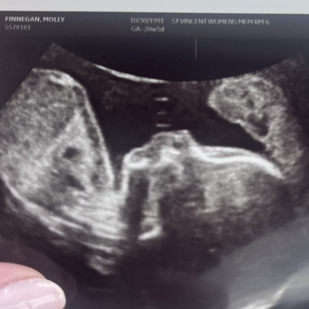 Photo shared by Molly for their Babylist baby registry.