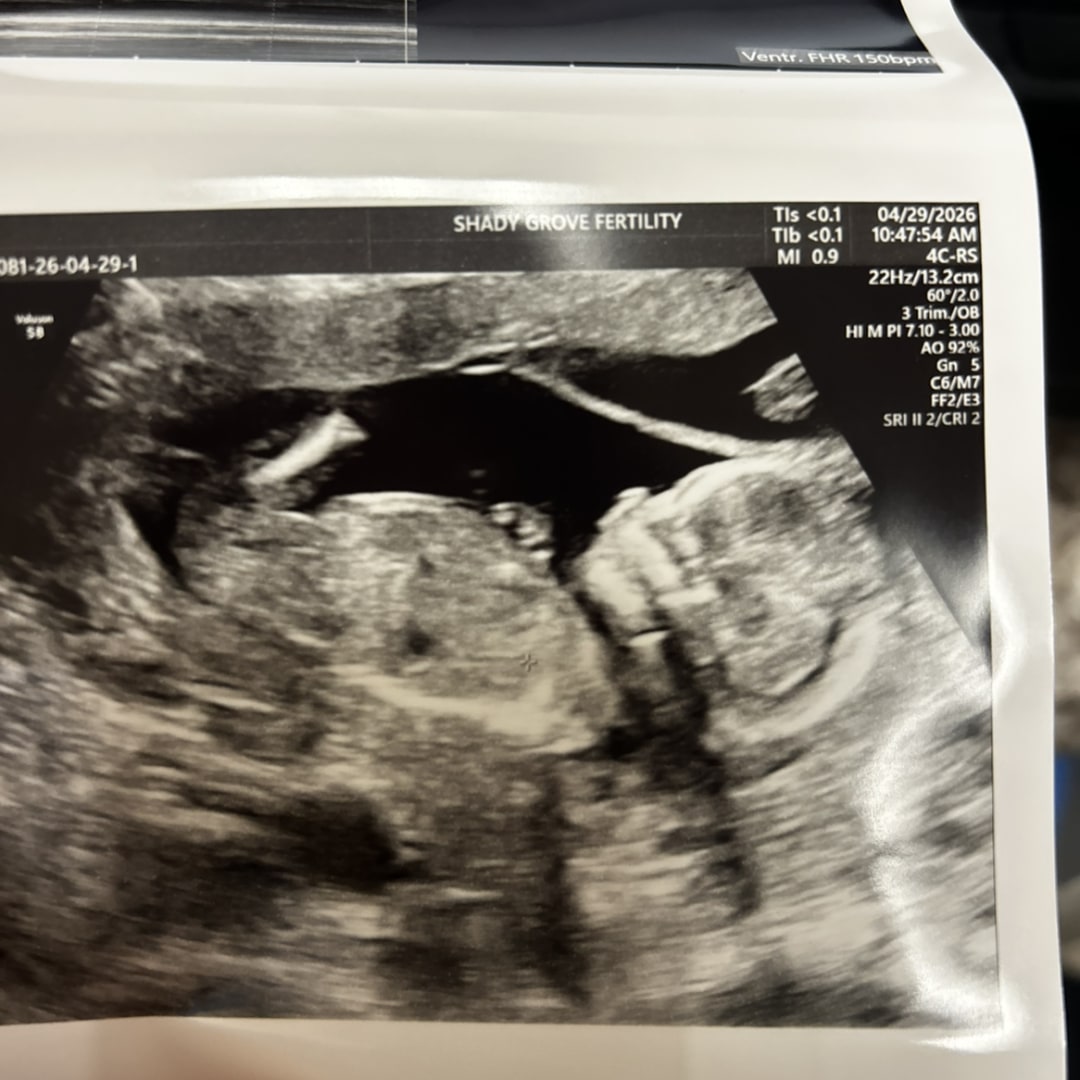 Photo shared by Hannah for their Babylist baby registry.