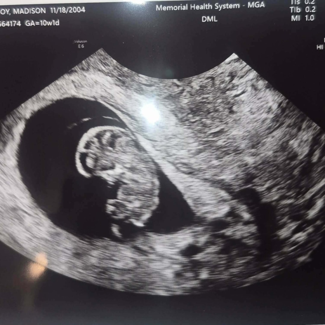 Photo shared by Madi for their Babylist baby registry.
