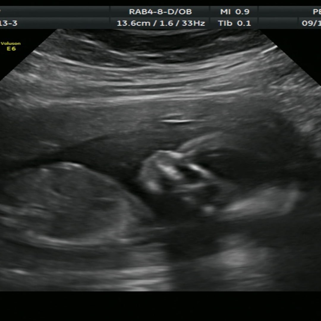 Photo shared by Abigail for their Babylist baby registry.