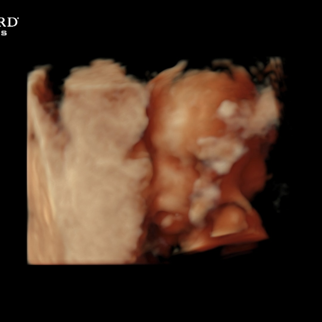 Photo shared by Jasmine for their Babylist baby registry.