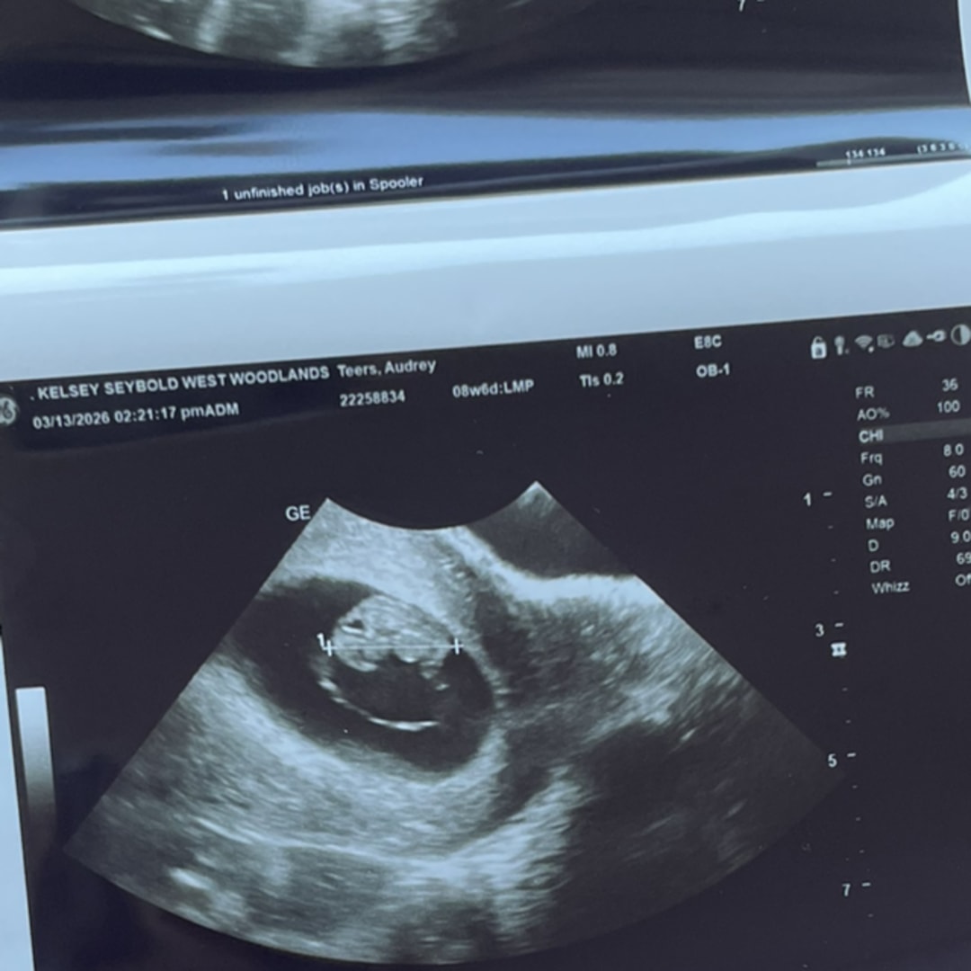 Photo shared by Audrey for their Babylist baby registry.