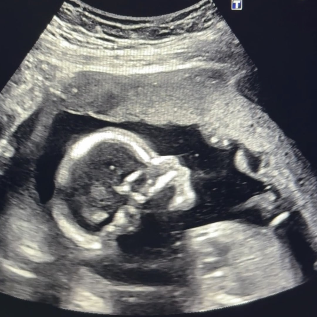 Photo shared by Nicole for their Babylist baby registry.