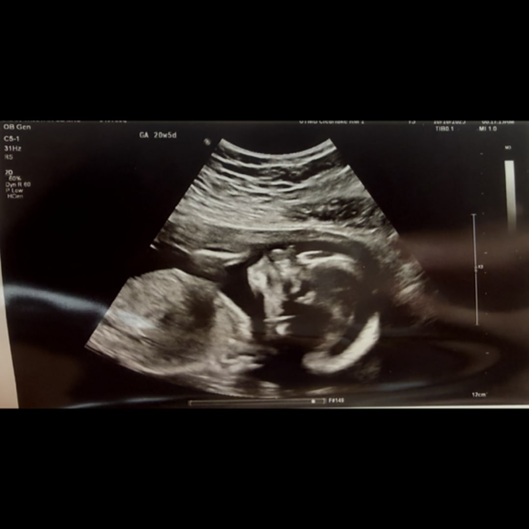 Photo shared by Tristan for their Babylist baby registry.