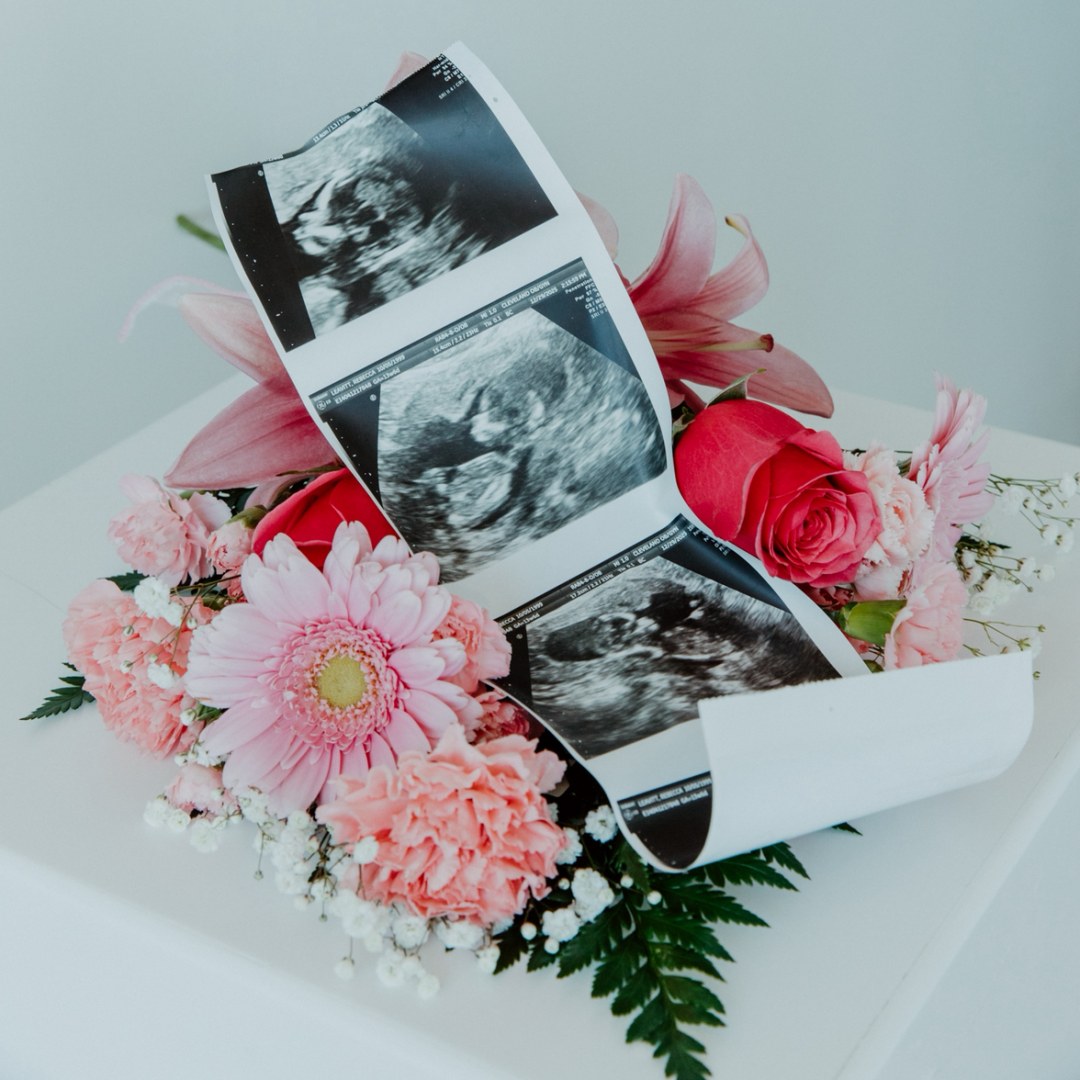 Photo shared by Rebecca for their Babylist baby registry.