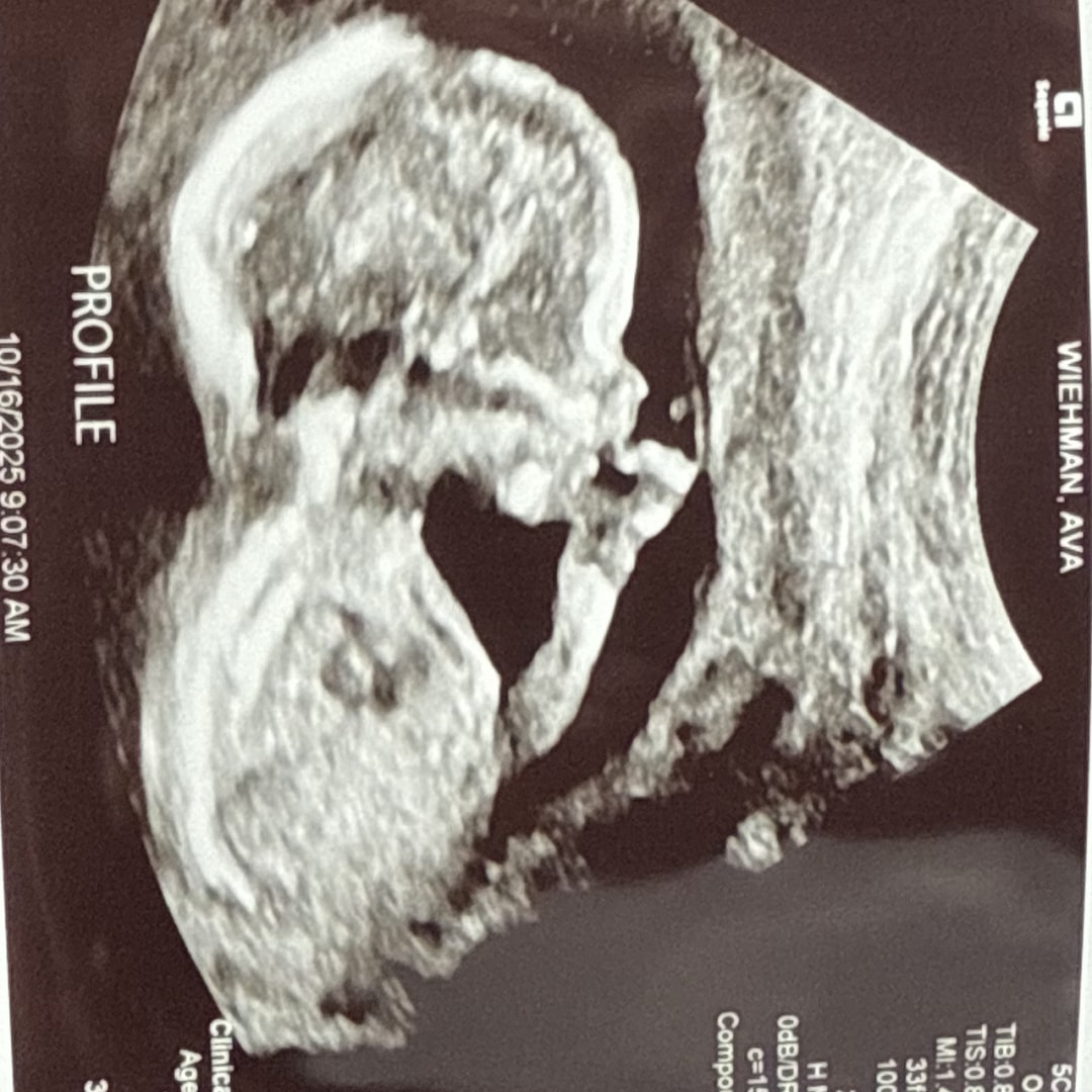 Photo shared by Ava for their Babylist baby registry.