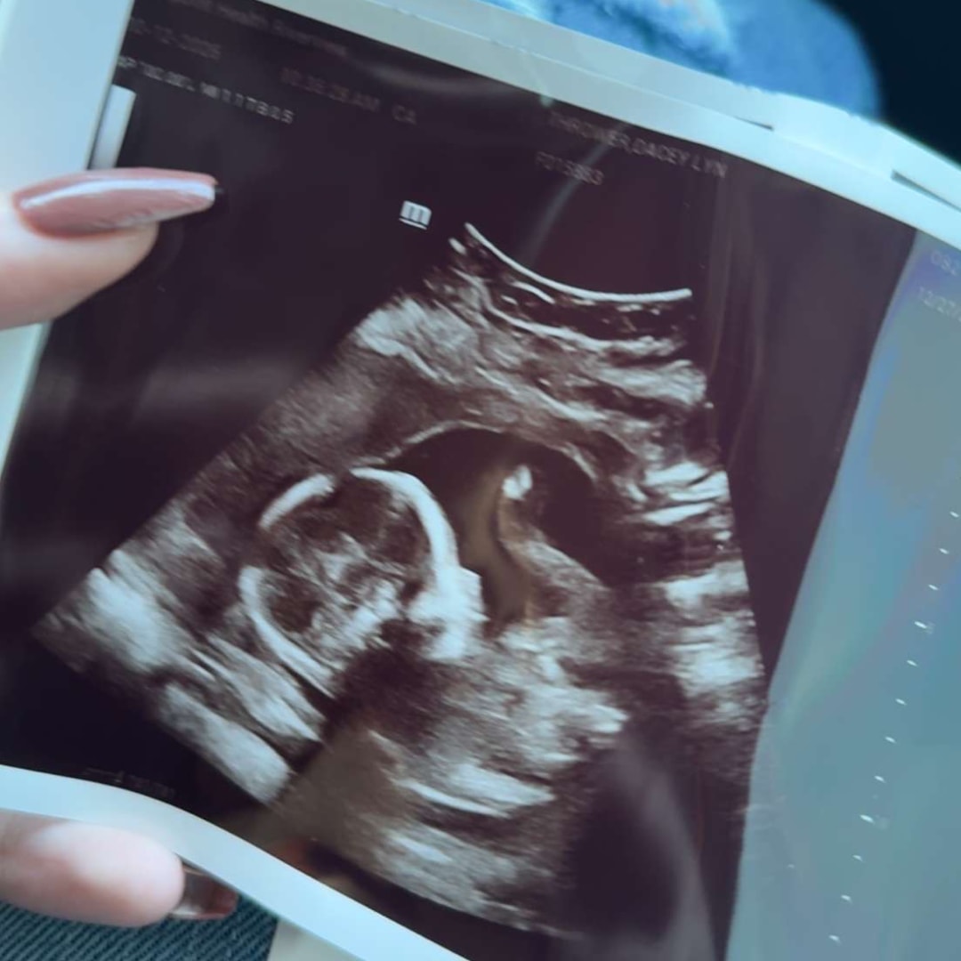 Photo shared by Dacey for their Babylist baby registry.