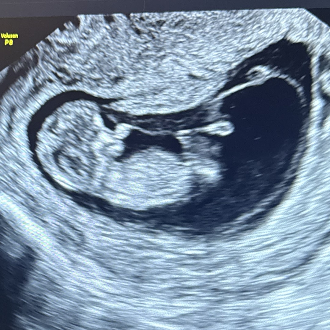 Photo shared by Katie for their Babylist baby registry.