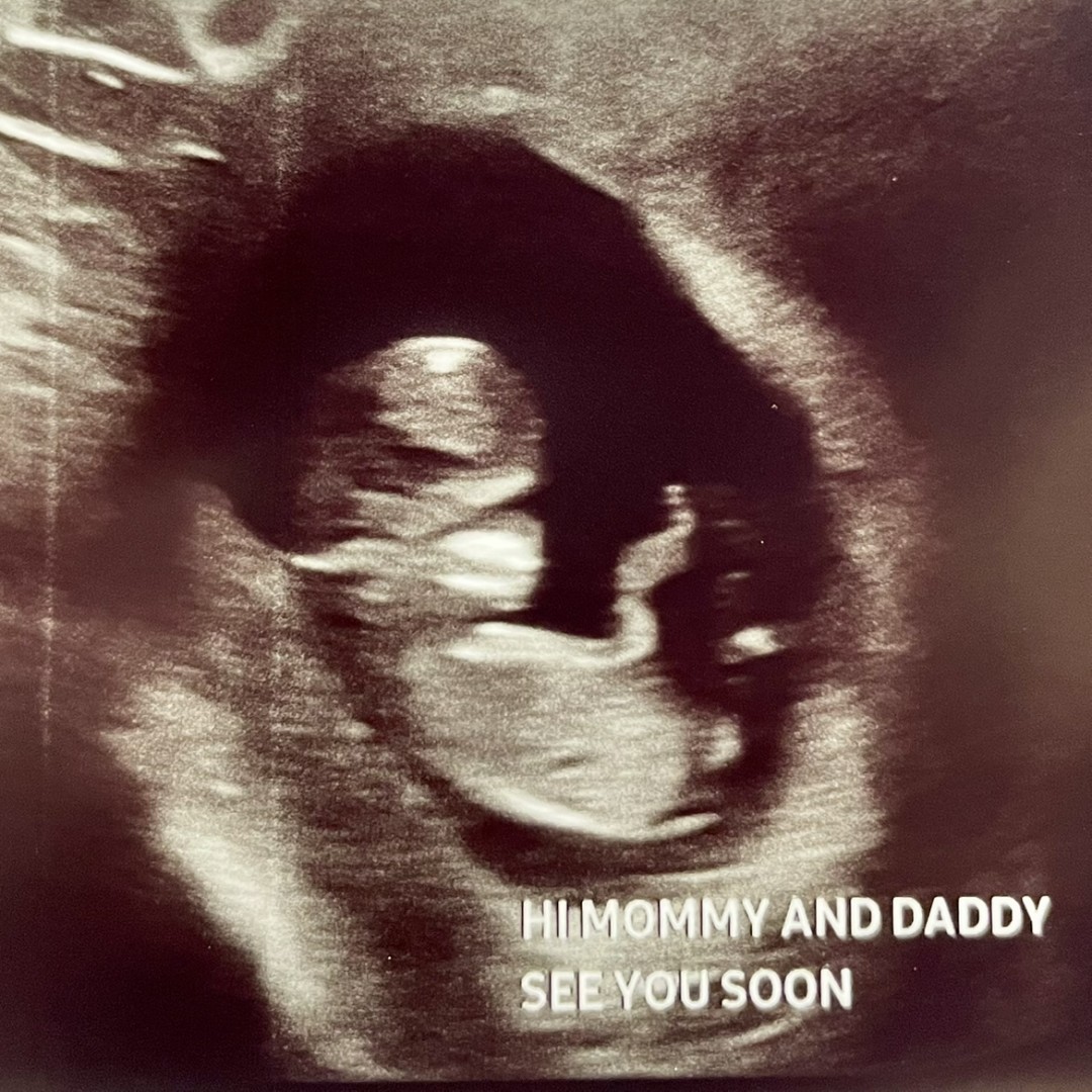 Photo shared by Alexis for their Babylist baby registry.