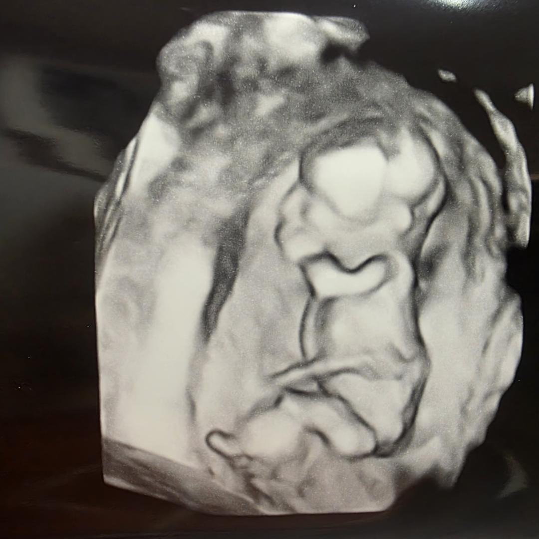 Photo shared by Kaitlin for their Babylist baby registry.