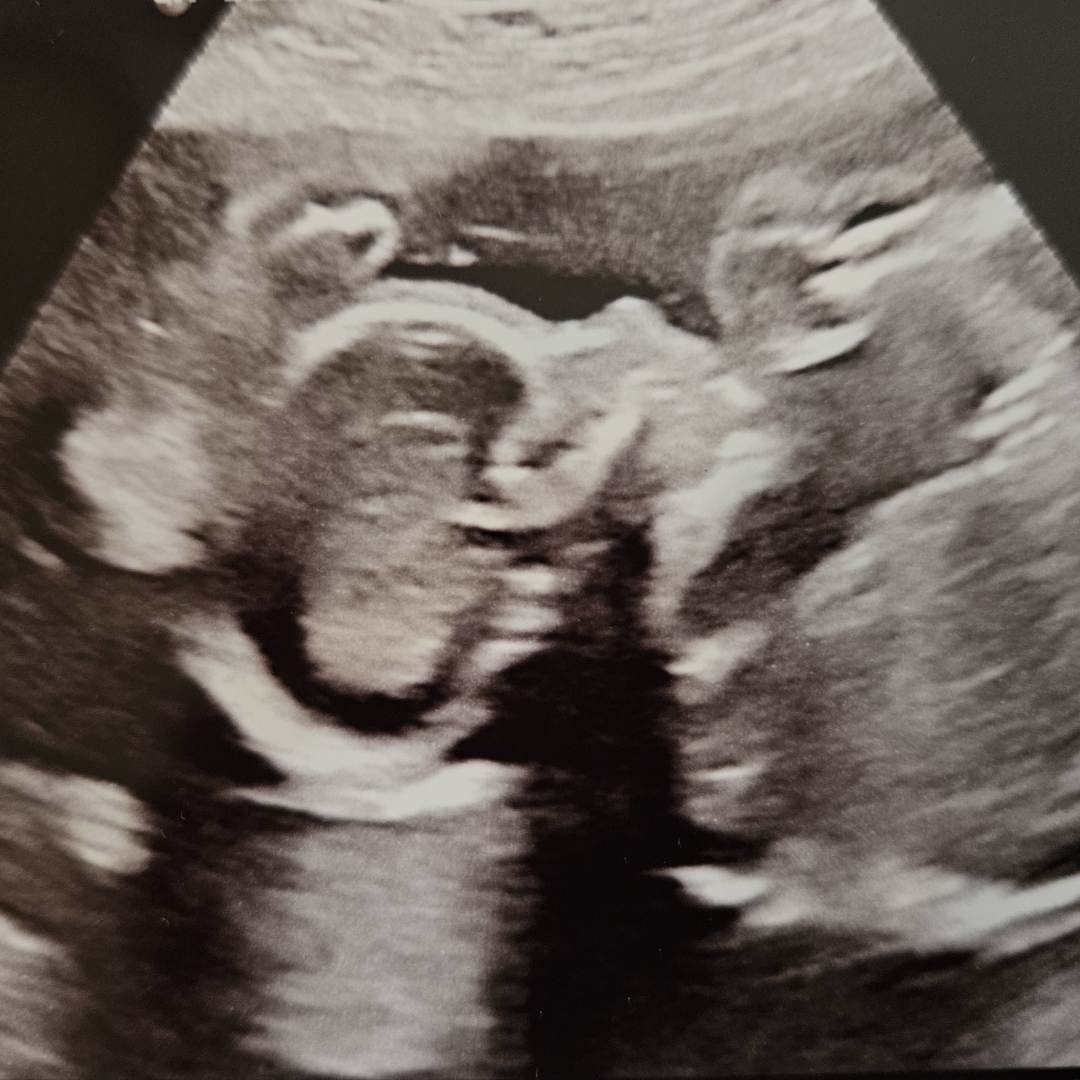 Photo shared by Kate for their Babylist baby registry.
