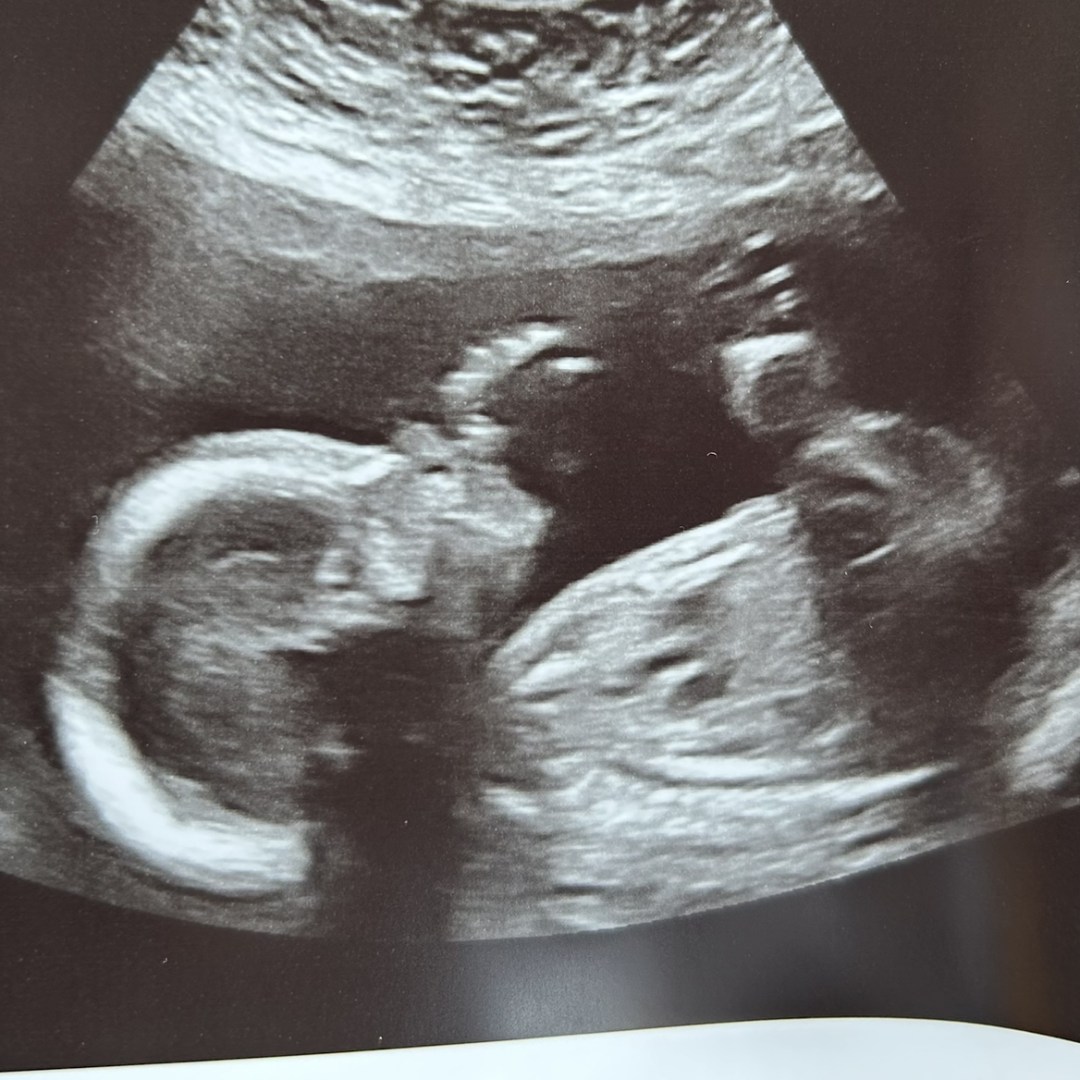 Photo shared by Kate for their Babylist baby registry.