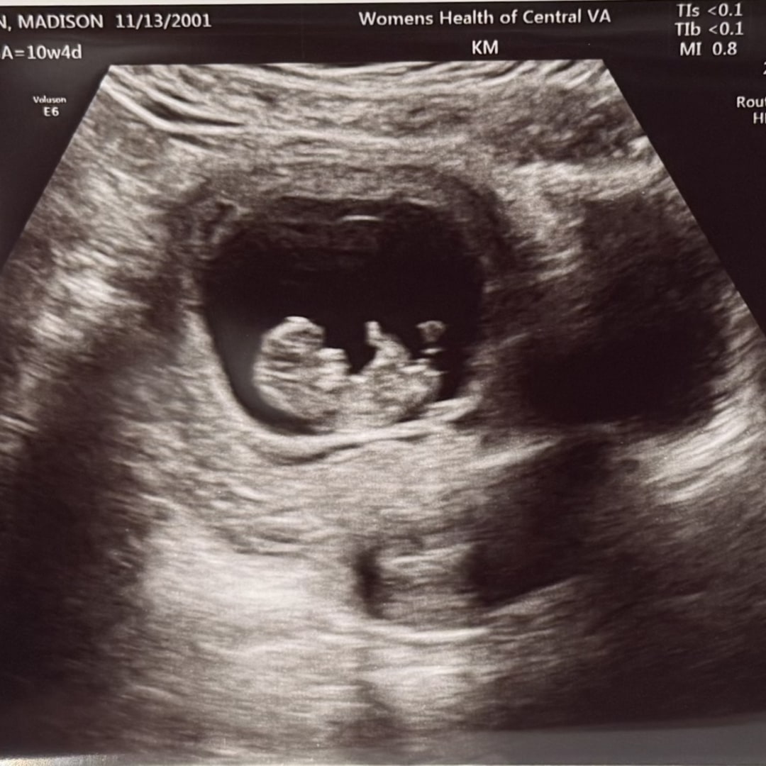Photo shared by Madison for their Babylist baby registry.