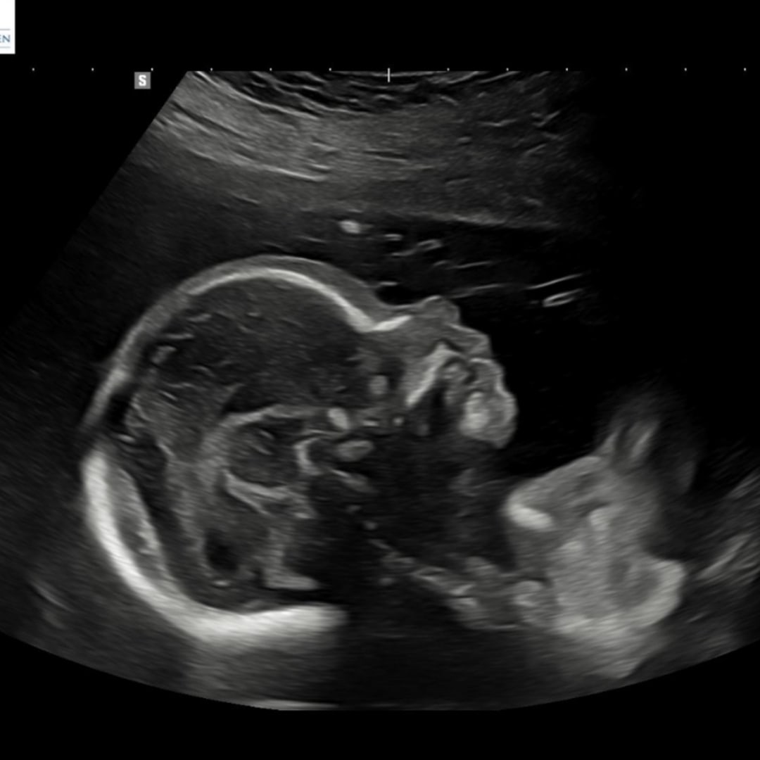 Photo shared by Erin for their Babylist baby registry.