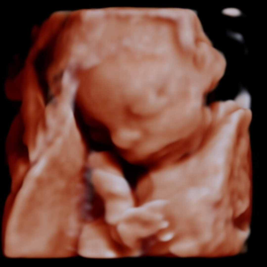 Photo shared by Kaitlyn for their Babylist baby registry.