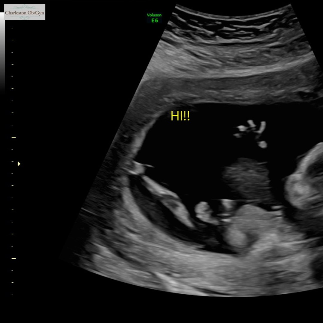 Photo shared by Aly for their Babylist baby registry.