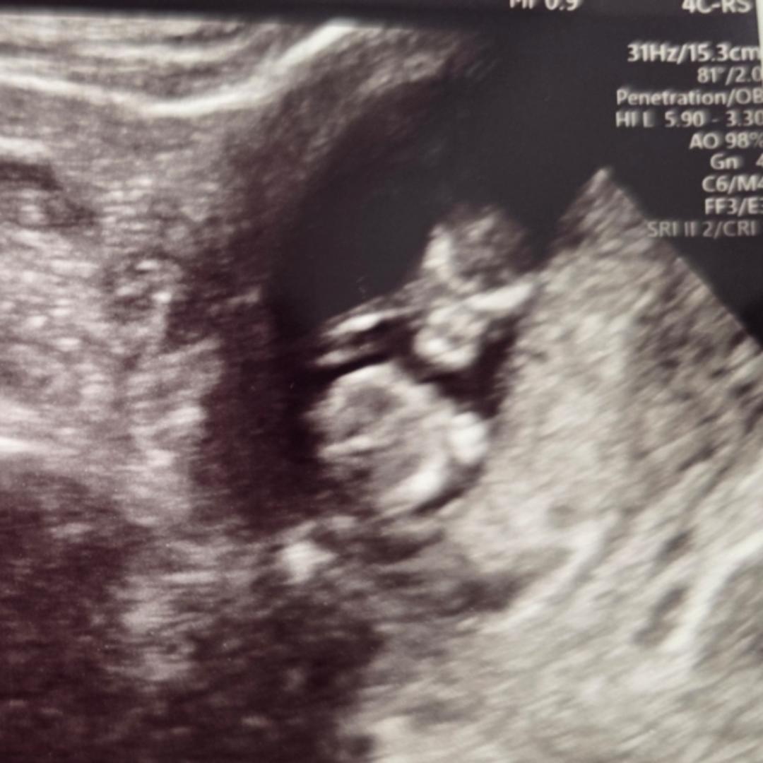 Photo shared by Ariane for their Babylist baby registry.