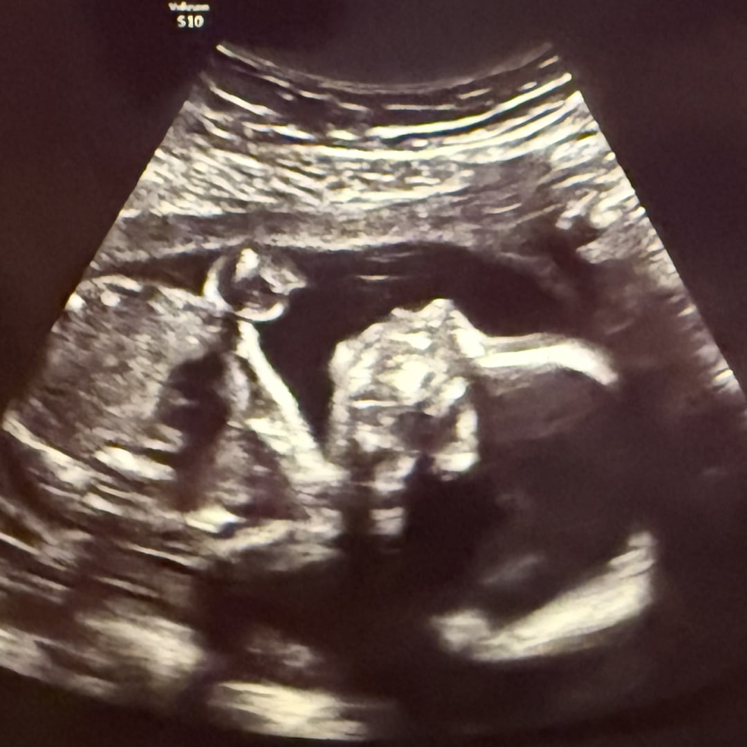 Photo shared by Gracie for their Babylist baby registry.