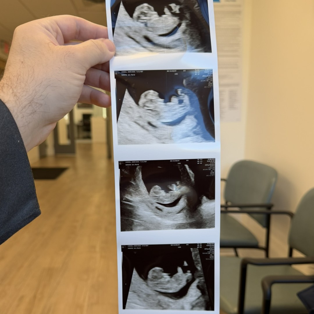 Photo shared by Mercedes for their Babylist baby registry.