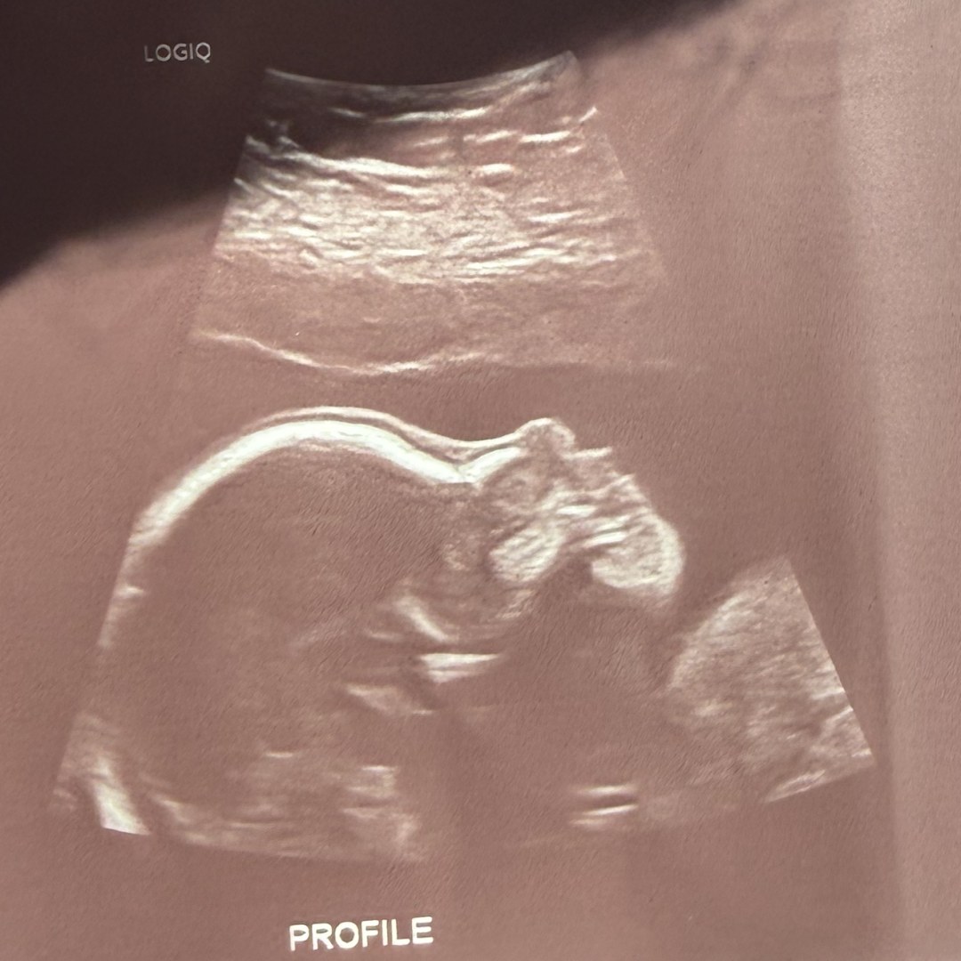 Photo shared by Hailey for their Babylist baby registry.