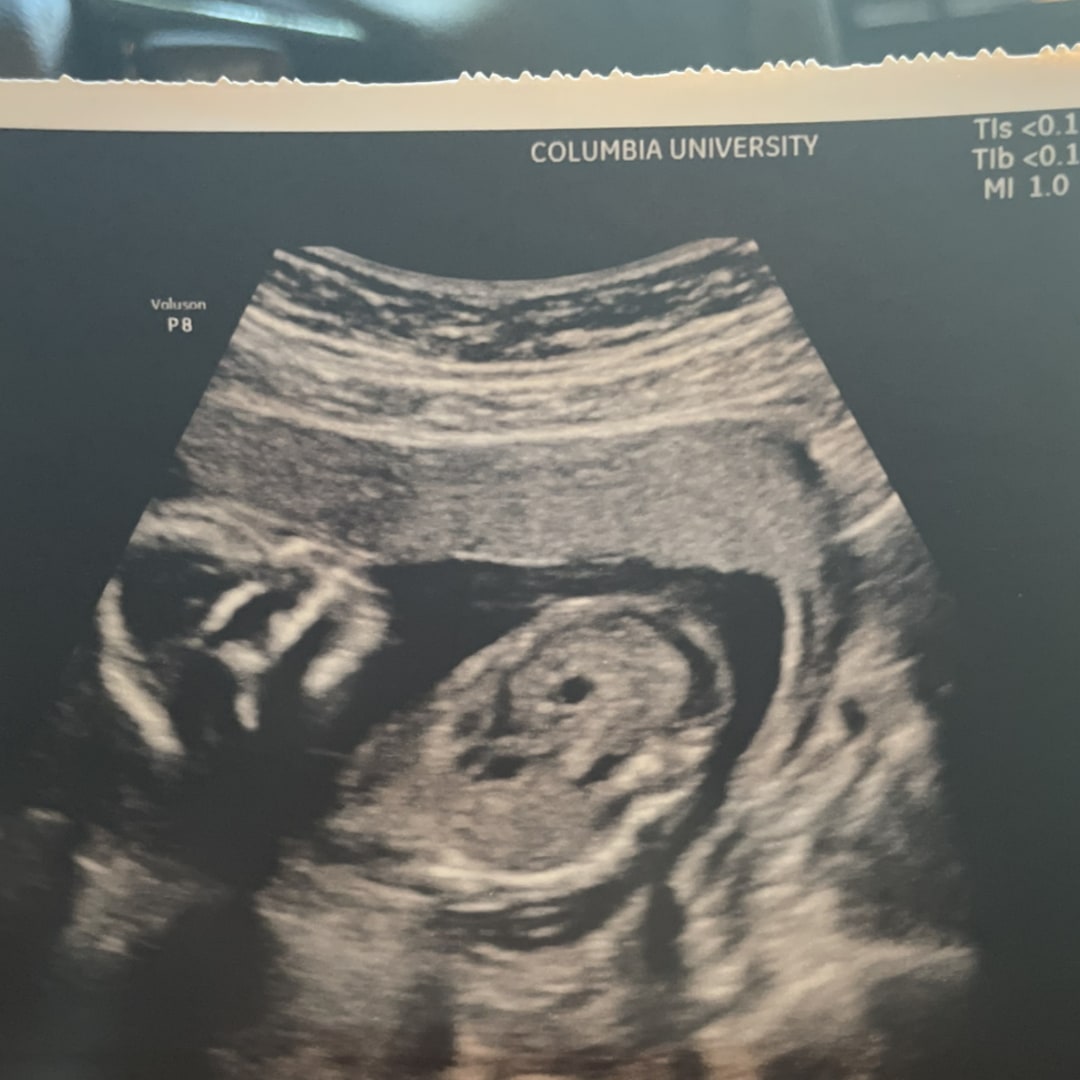 Photo shared by Amanda for their Babylist baby registry.